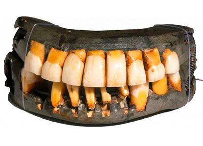 dentadura-de porcelana-ceramica